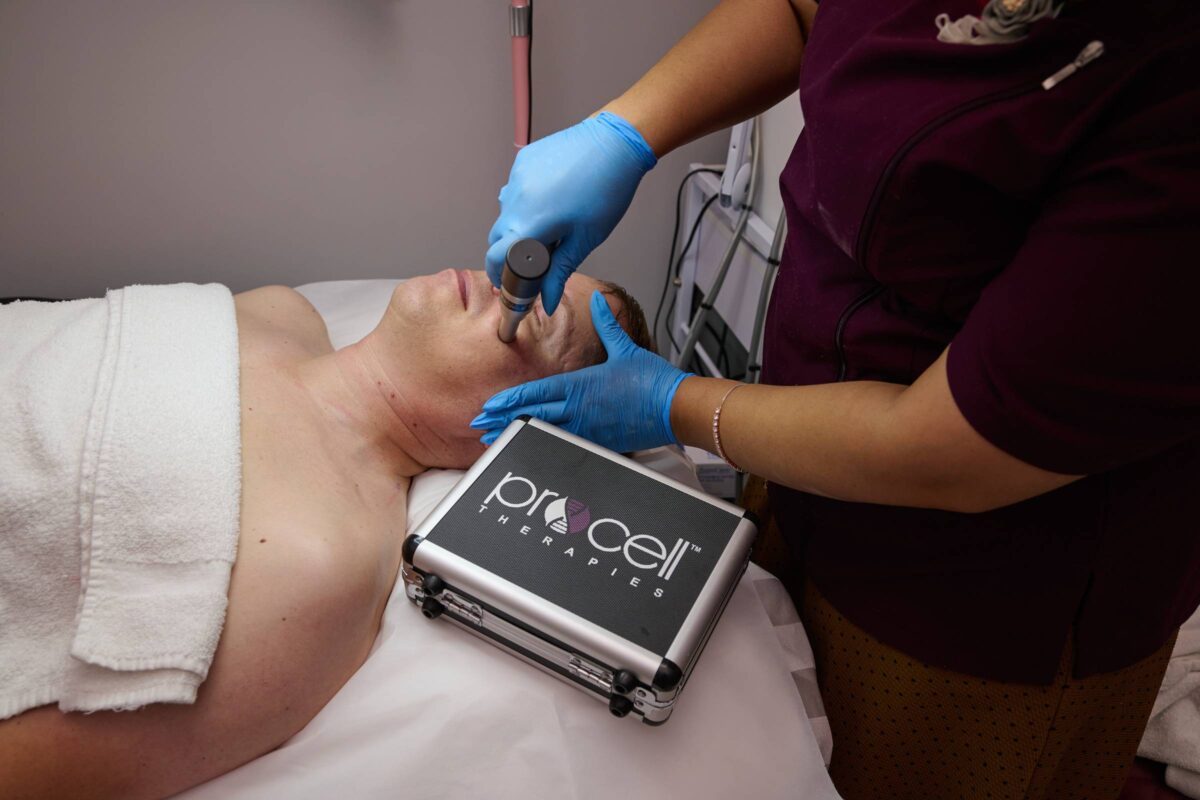 Men's Facial Microchannelling - Image 277 - Lavish Spa 387