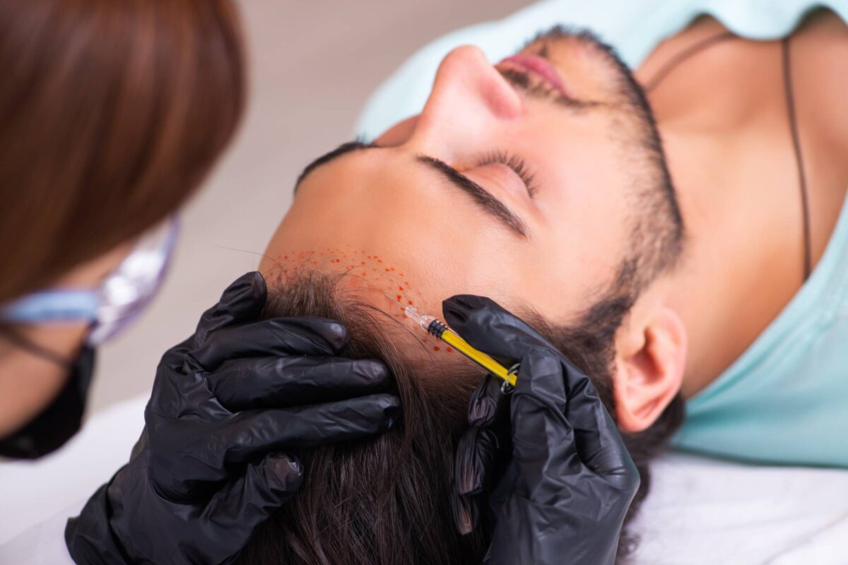 ProCell Hair Loss Treatment for Men - Image - Lavish Spa 387