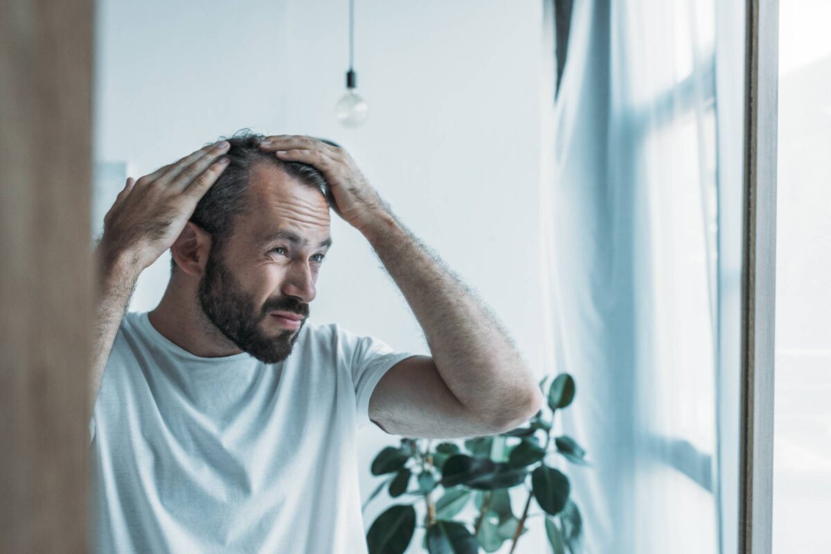 ProCell Hair Loss Treatment for Receding Hairlines - Image - Lavish Spa 387
